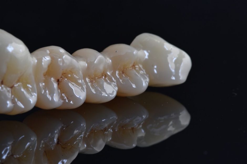 Dantų protezavimas: kodėl cirkonio keramika turi savo kainą? 