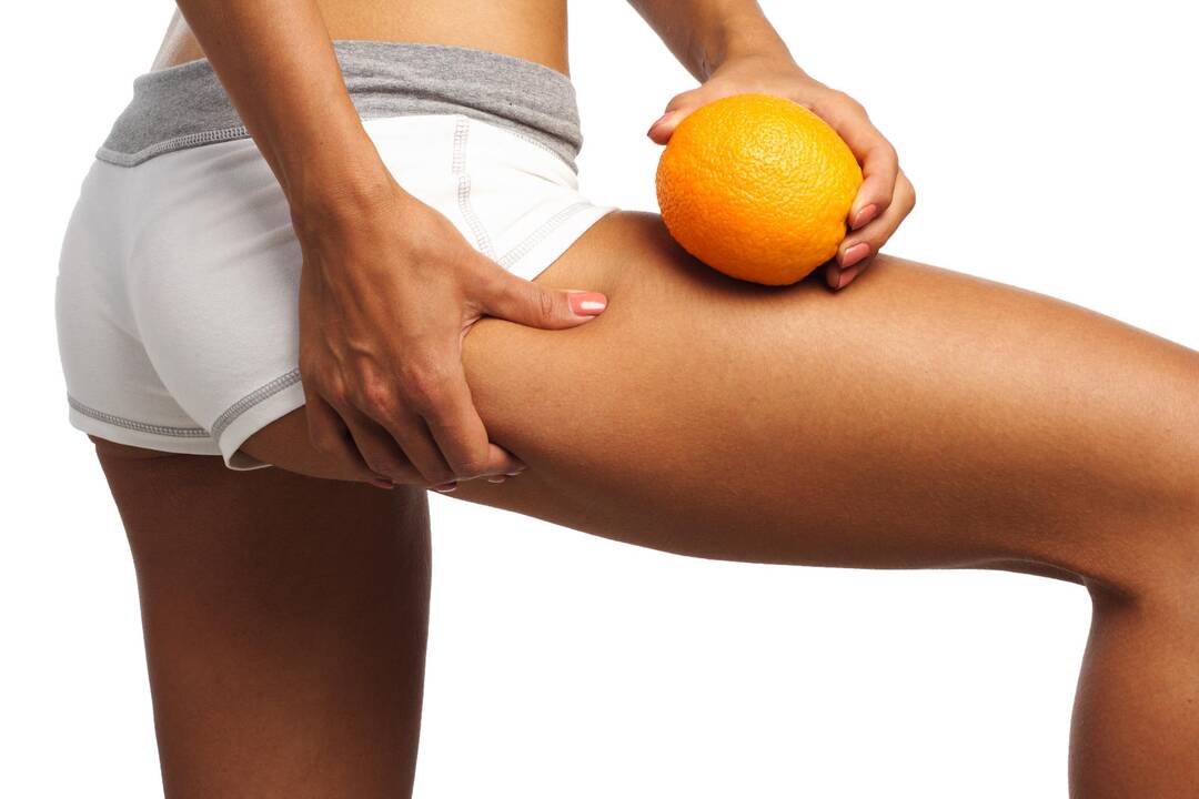 How to get rid of cellulite?