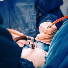 Kauno klinikose atlikta transplantacija, kai donoro ir recipiento kraujo grupės skirting
