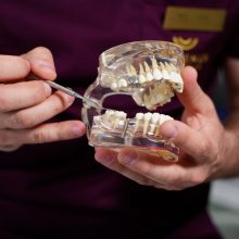 „Šypsenos akademijoje“ –  itin žemos dantų implantacijos kainos