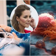 Velso princesei Kate taikoma prevencinė chemoterapija: paaiškino, kas tai  