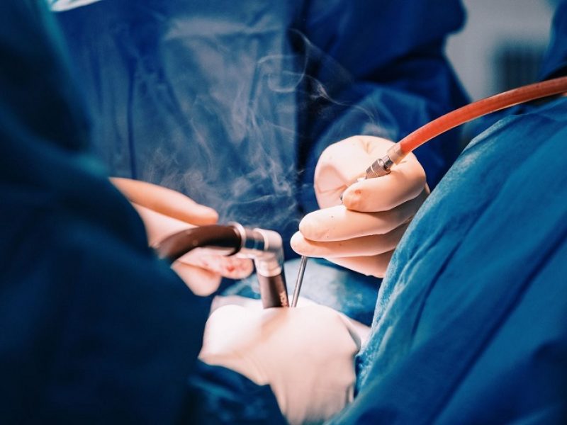 Pirmą kartą Kaune atlikta nesuderinamos kraujo grupės inksto transplantacija