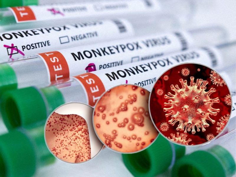 Medikai – apie pasiruošimą tirti ir gydyti nuo beždžionių raupų, gerą pamoką ir svarbiausius dalykus