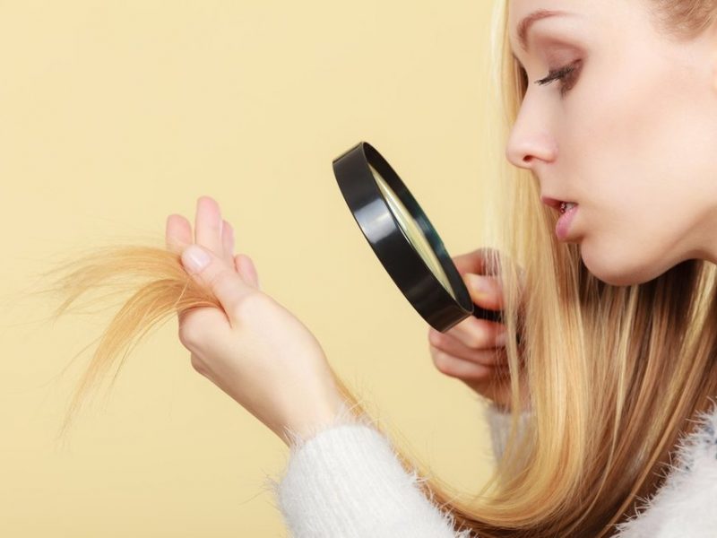 Suprastėjo plaukų ir nagų būklė: ką tai sako apie sveikatą?