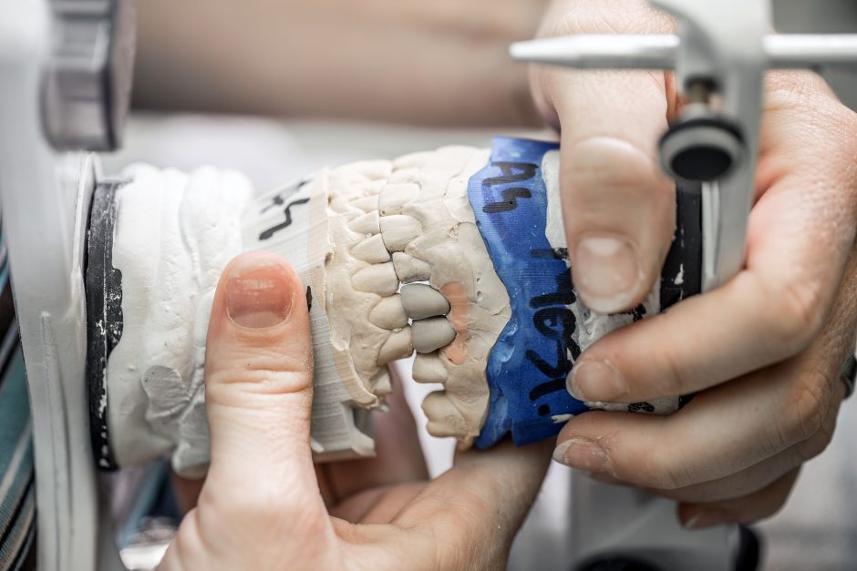 Odontologijoje – revoliucija: protezų laukti kelerius metus nebereikės 