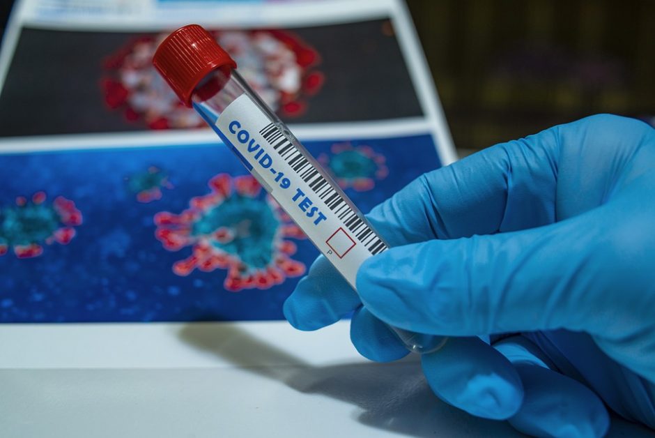 Lietuvoje patvirtinti penki nauji koronaviruso atvejai