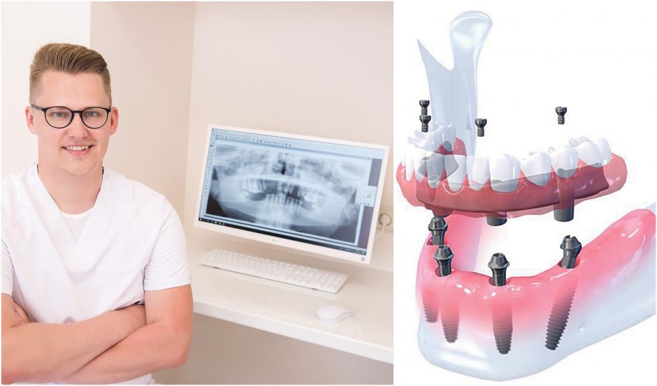 Dantų implantacija Garliavoje. Kuo stebina nauja klinika?