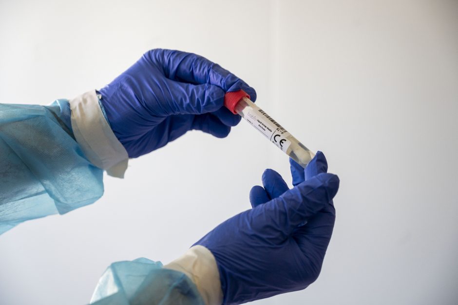 Šveicarijoje užfiksuotas rekordinis naujų koronaviruso atvejų skaičiaus paros prieaugis