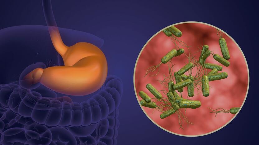 Pavojinga: H. Pylori bakterija kolonizuoja žmogaus skrandį ir atlieka pagrindinį vaidmenį daugelio virškinamojo trakto ligų išsivystyme.