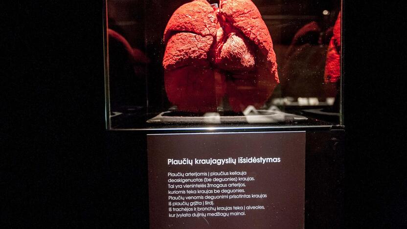 "Body worlds vital" paroda Kaune