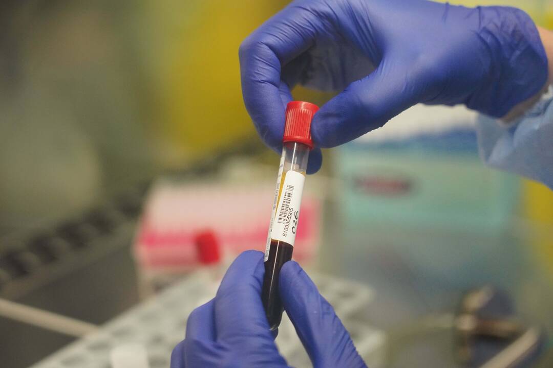 Europos vaistų agentūra pradėjo  „CureVac“  vakcinos nuo COVID-19 vertinimą