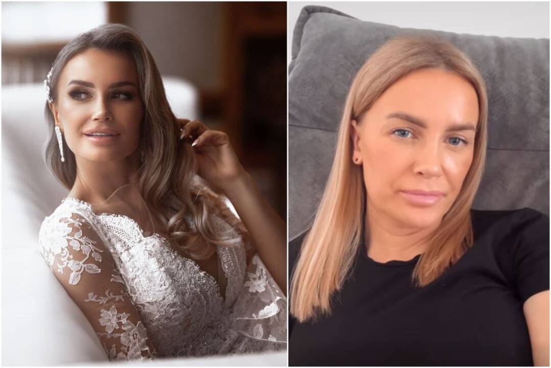 Kristina Meseguer prabilo apie tai, kodėl viešai dalijasi savo išgyvenimais