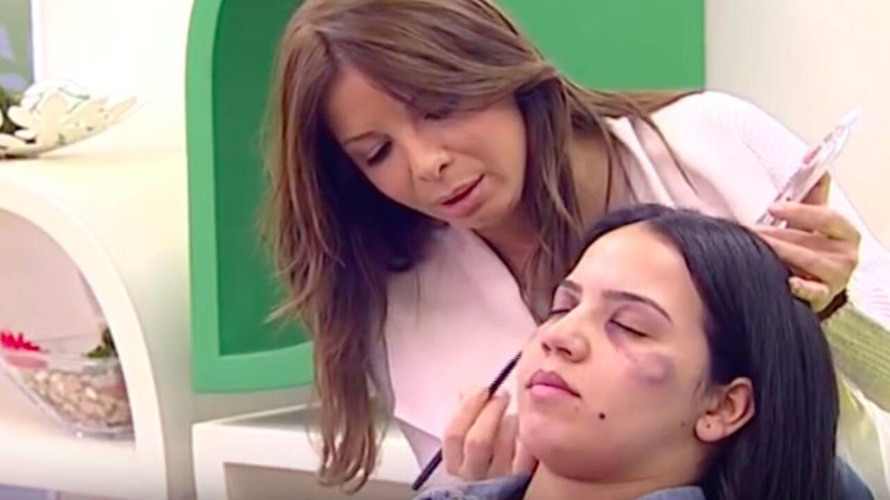 TV žiūrovams – pamoka, kaip makiažu paslėpti smurto žymes