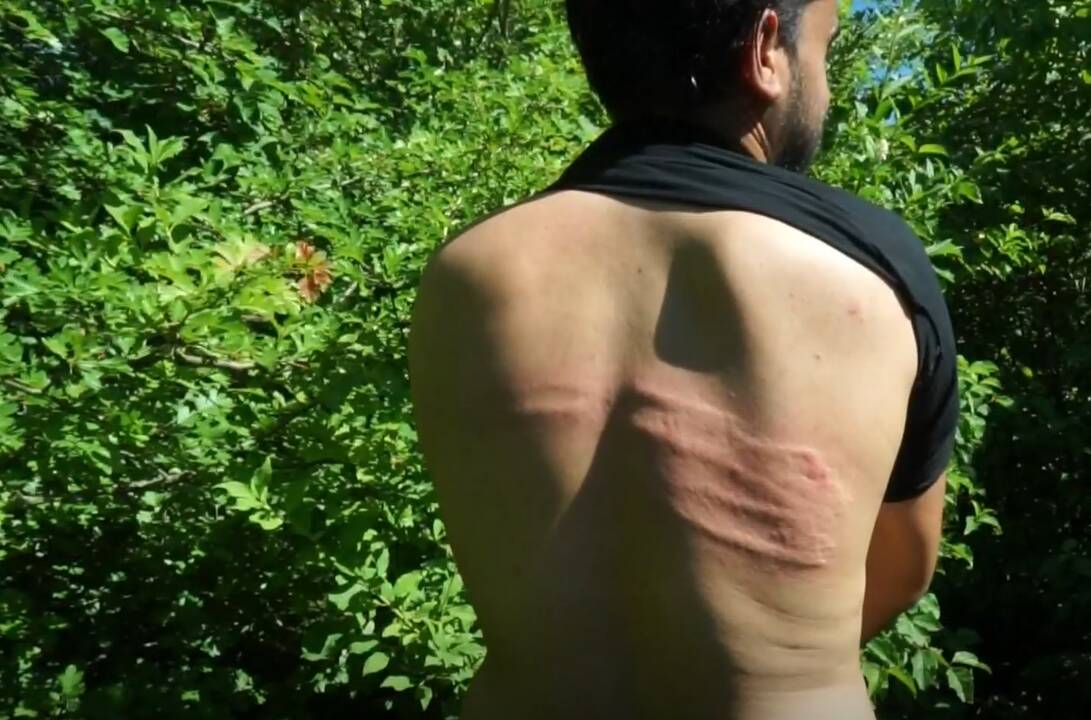 Šiurpūs vaizdai: vydami migrantus iš Kroatijos, pareigūnai lazdomis talžė ir nepilnamečius