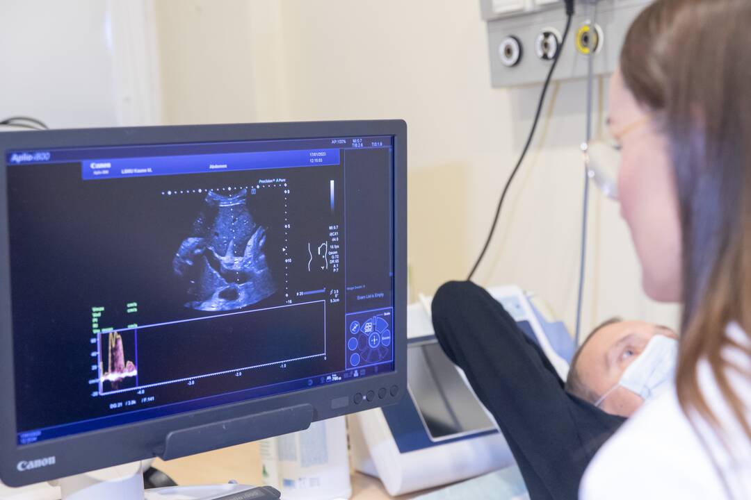 Kauno klinikų medikai – apie organų transplantacijas