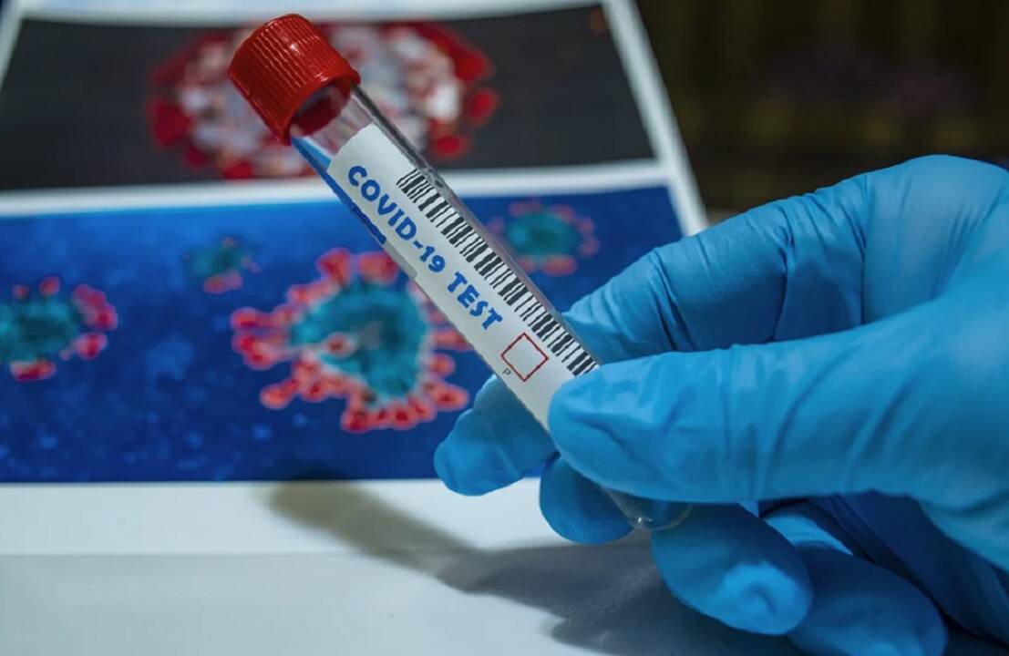 Asociatyvi nuotr.