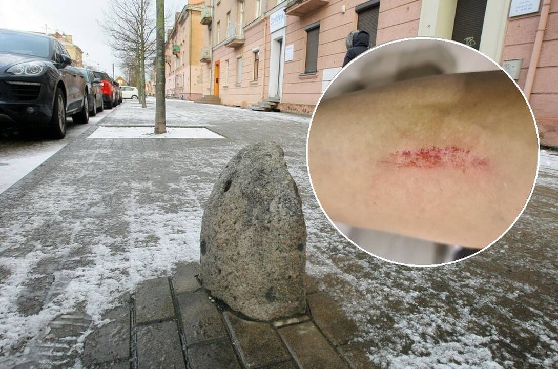 Paveldas: S.Šimkaus gatvėje yra du paveldiniai akmenys, kurie saugojami, kaip istorijos reliktas. Po įvykusios nelaimės juos nuspręsta paženklinti dėl pėsčiųjų saugumo.
