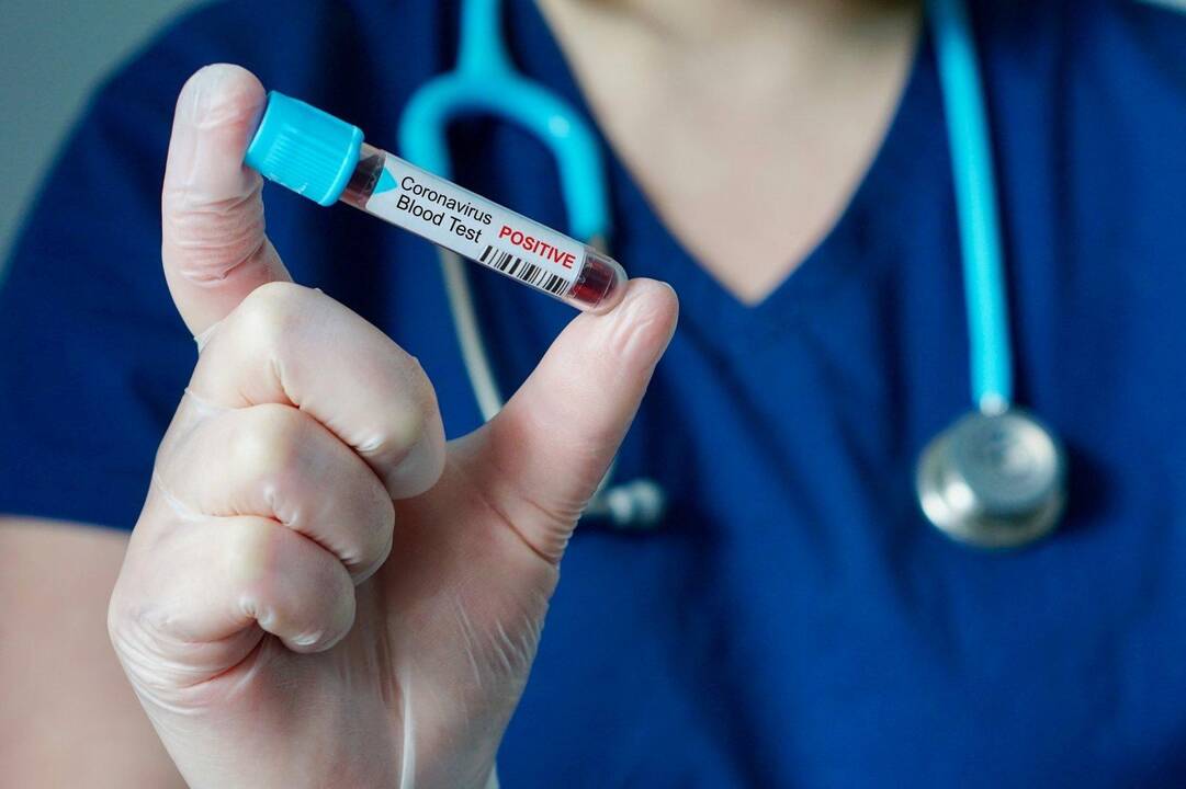 Koronavirusas Lietuvoje: tiriama dar 15 ėminių, naujų atvejų nėra