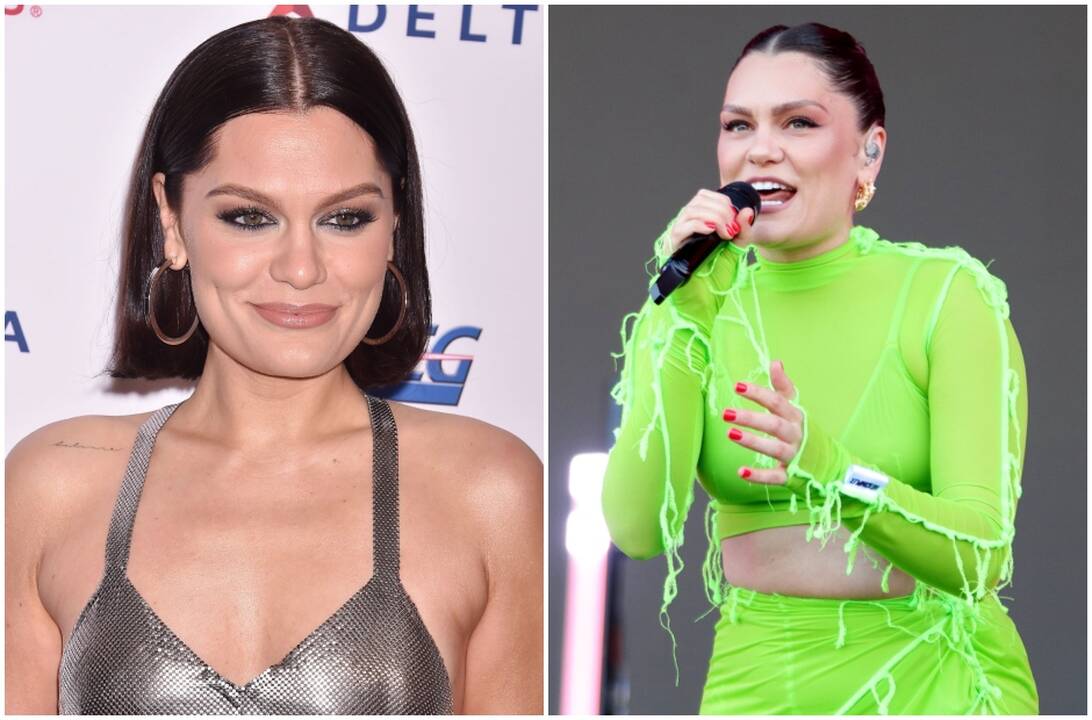 Atlikėjai Jessie J nustatyti rimti neurologiniai sutrikimai