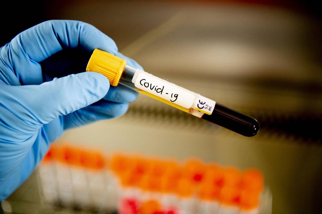 Prieš dvi savaites padarė koronaviruso testą, bet atsakymo nesulaukė iki Velykų