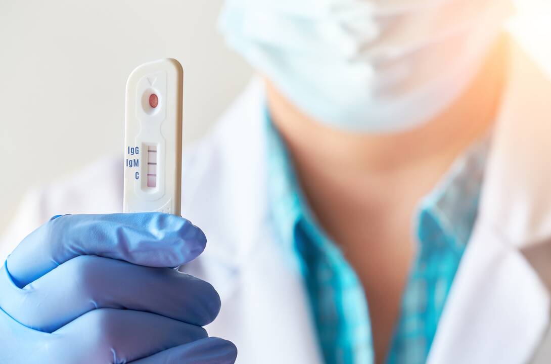 A. Dulkys apie darbuotojų testavimą: dabar jokios pagalbos verslui nėra