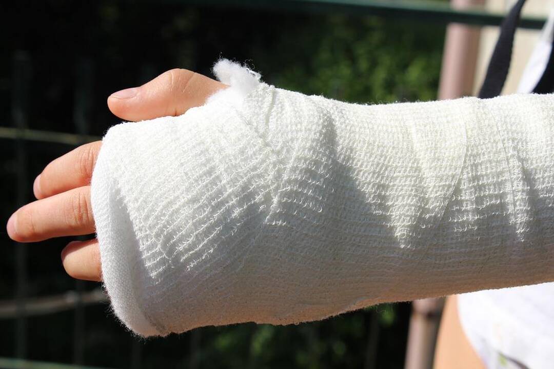 Ieško eismo įvykio liudininkų: po susidūrimo dviratininkui lūžo ranka