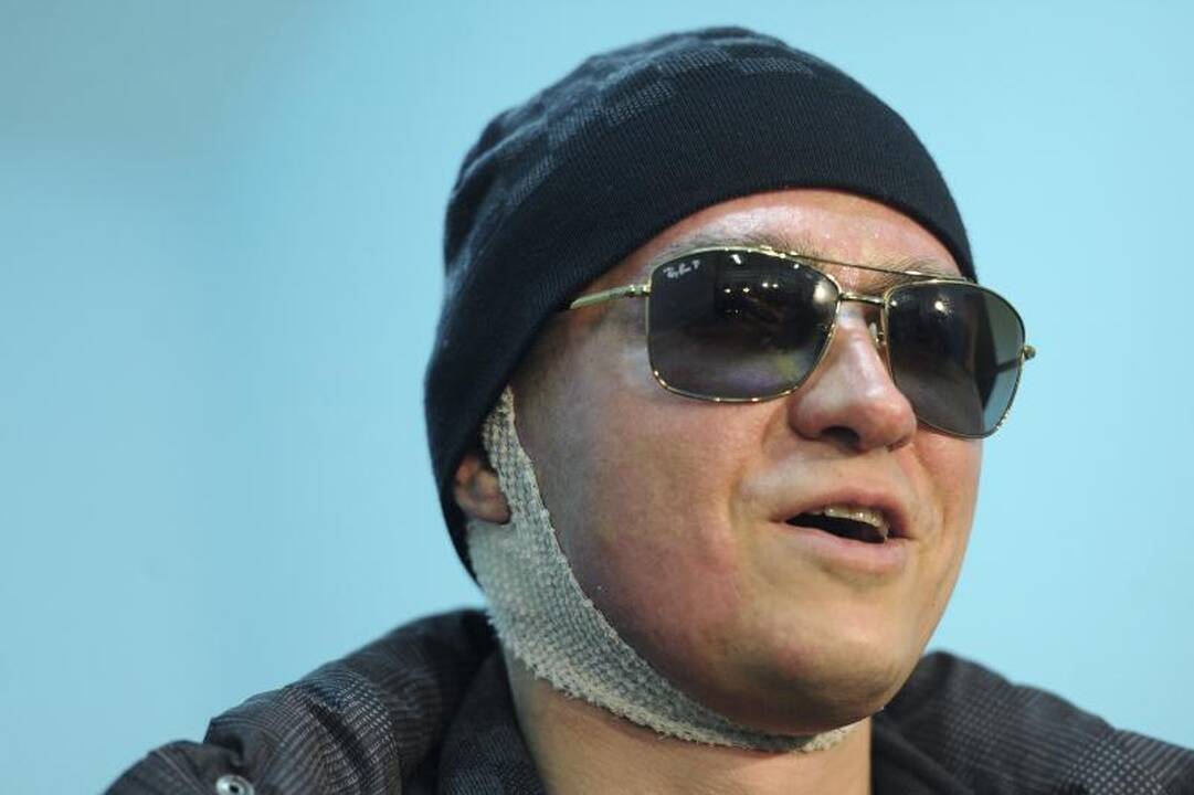 Rusijos policija sulaikė įtariamąjį išpuoliu prieš S. Filiną