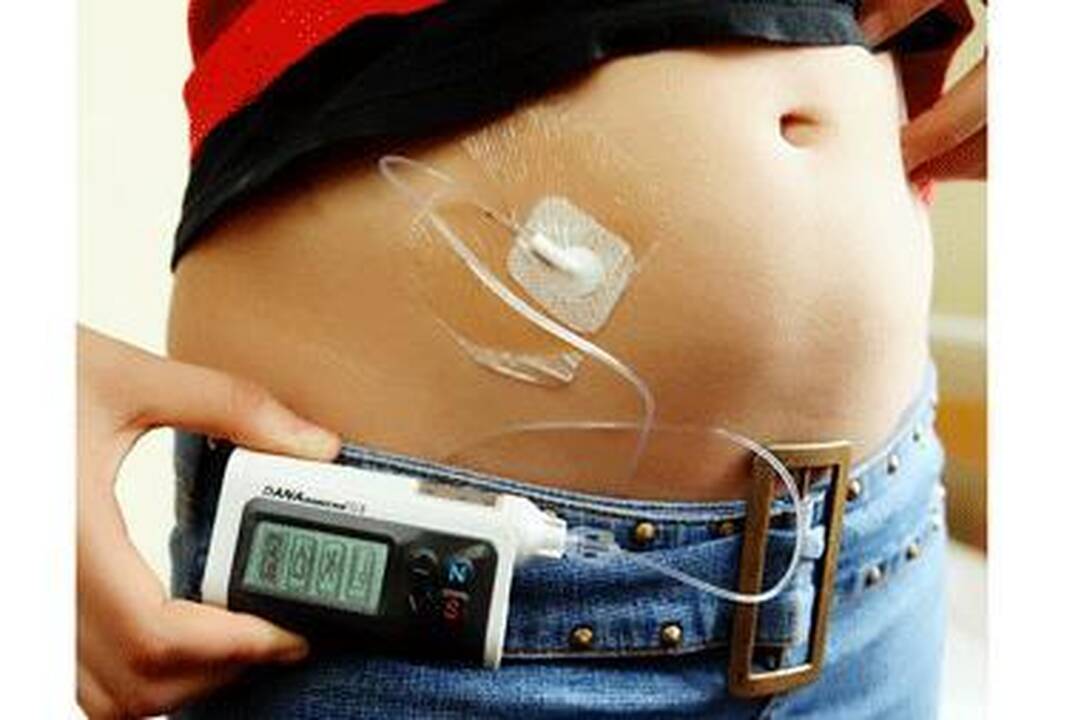 Vaistas nuo diabeto gali sukelti vitamino B12 nepakankamumą