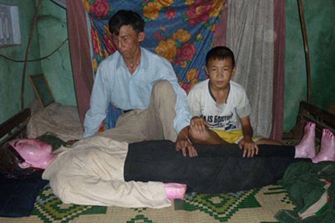 Vietnamietis su mirusia žmona miega jau septynerius metus (foto)