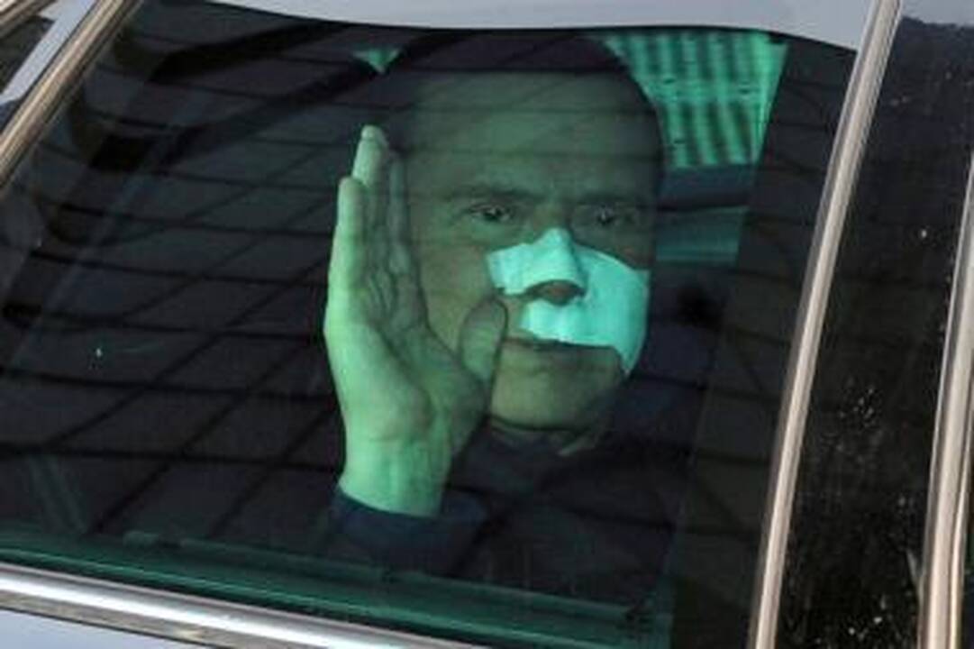 Užpuoliko sužalotas S.Berlusconi išėjo iš ligoninės