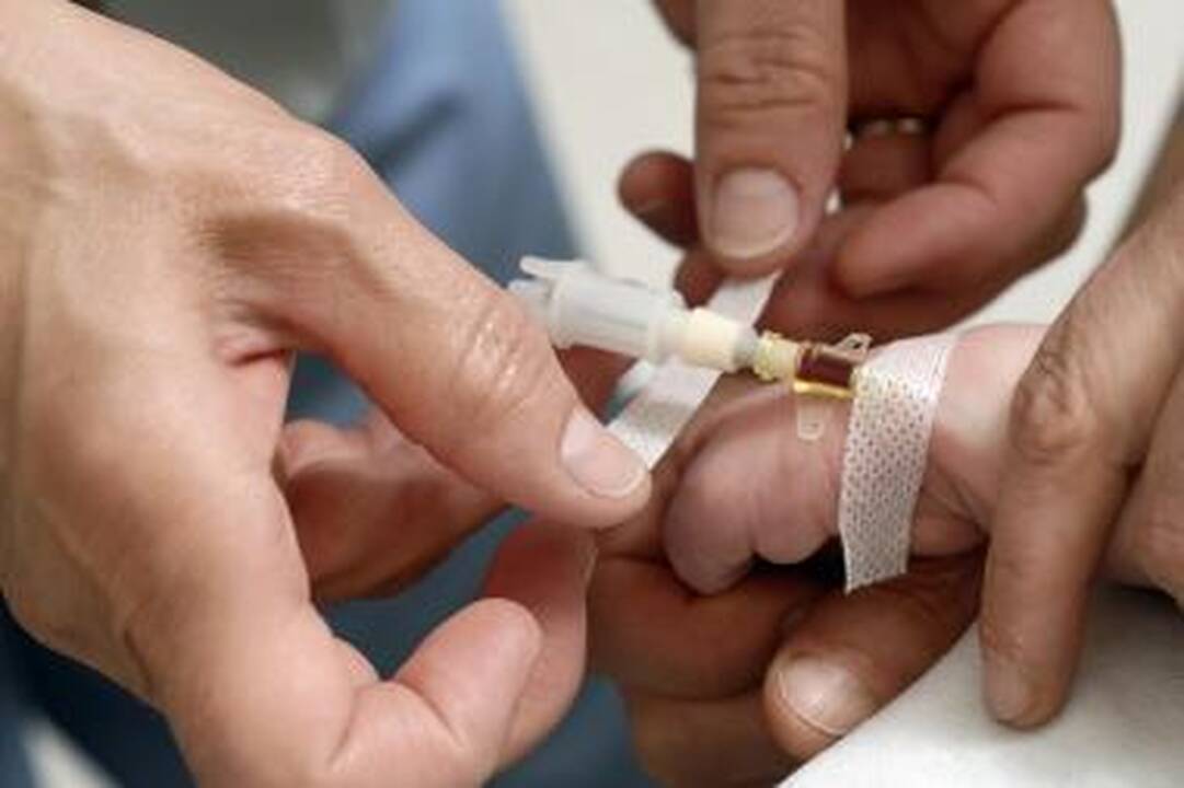 Šešiametis susirgo reta liga