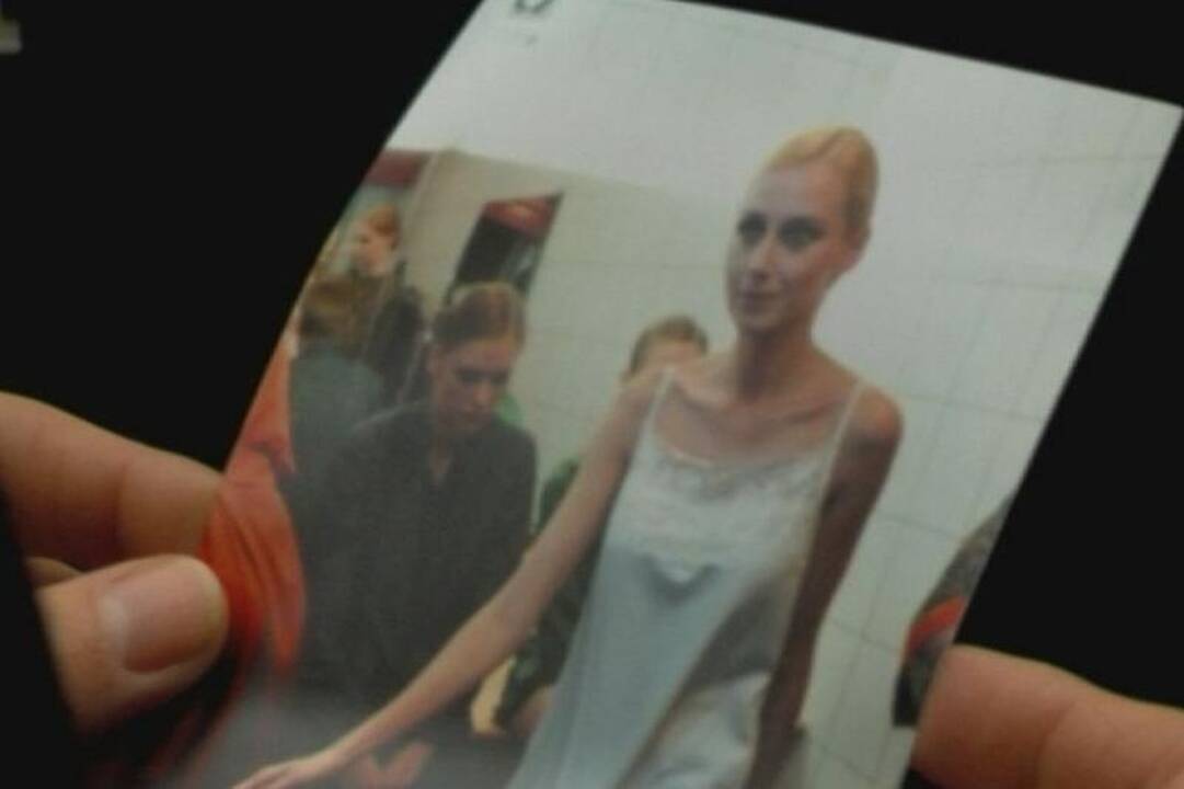 Viešumos vengianti V. Repčenkaitė-Vosylė serga anoreksija?