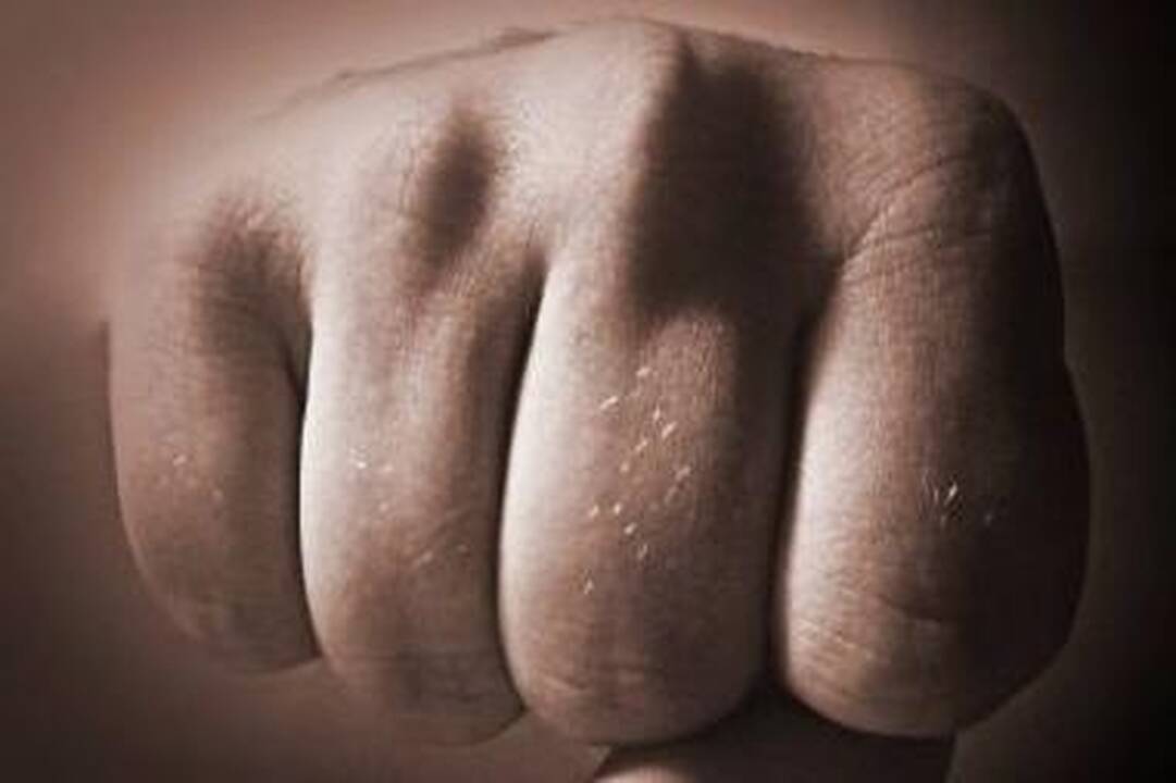 Girtas tėvas sužeidė dvimetį sūnų