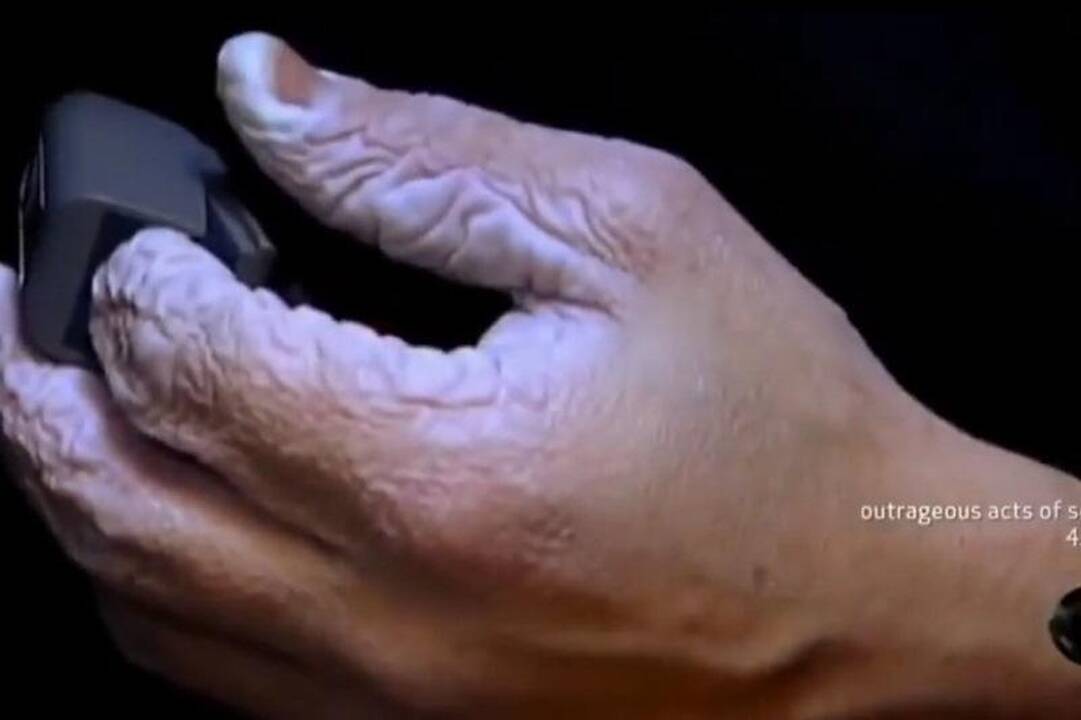 Kaip atrodo 10 dienų vandenyje mirkusios rankos? 