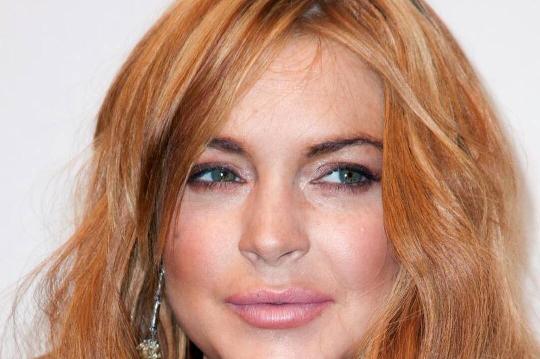 Per daug ir per anksti? L. Lohan ištinęs veidas – botokso pasekmė