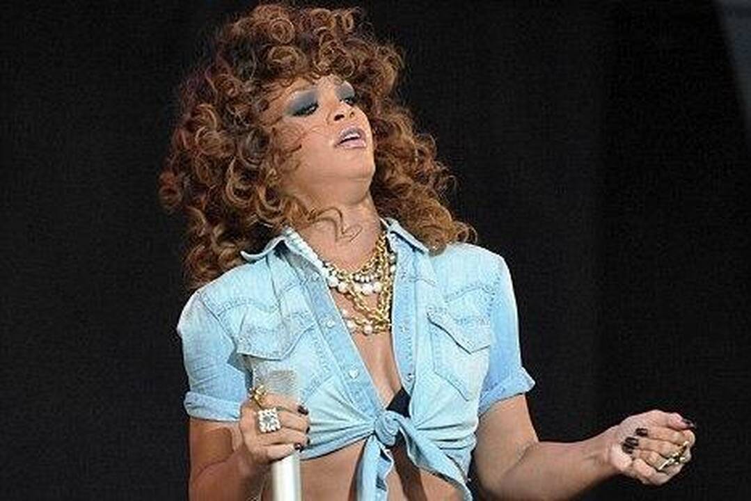 Rihanna gerbėjams pademonstravo savo randą