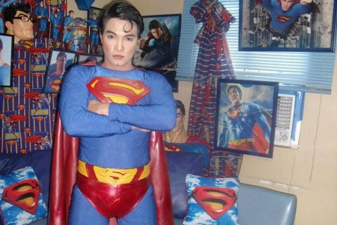 Vyras iškentė kelias operacijas, kad būtų panašus į Supermeną