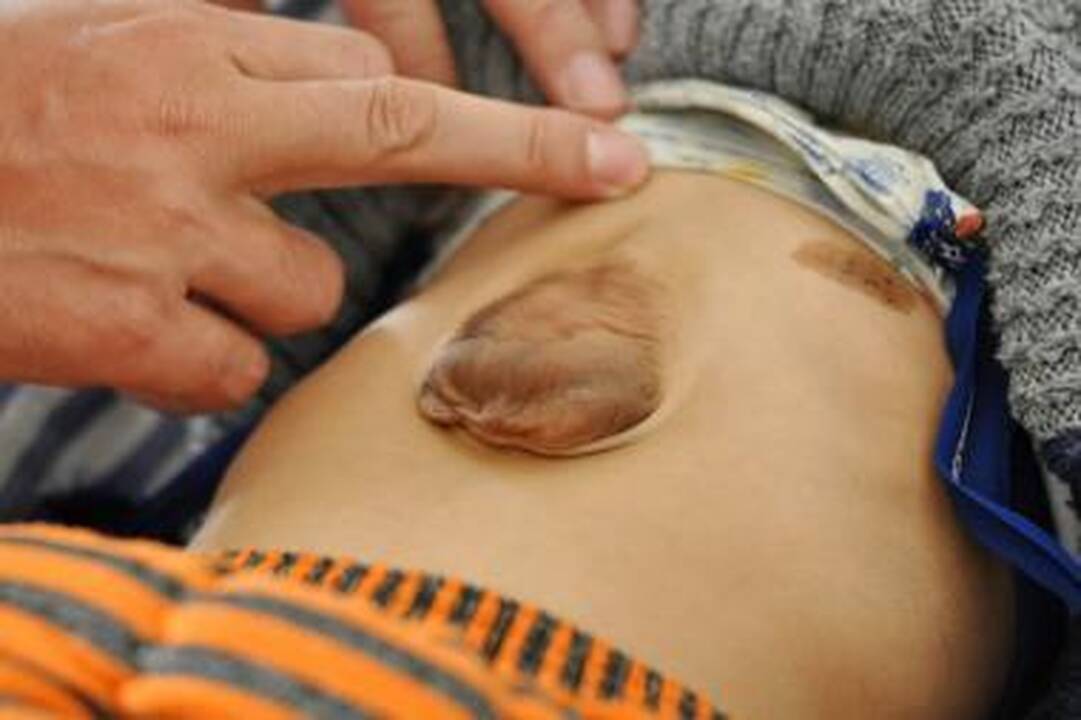 Širdis plaka pilve