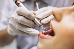 Vyriausybė sutinka Odontologų rūmams atiduoti tik dalį licencijavimo