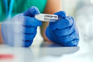 Per parą šalyje – 44 koronaviruso atvejai
