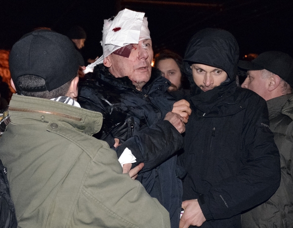 Ukrainos opozicijos lyderis J. Lucenka po incidento su milicija paguldytas į ligoninę