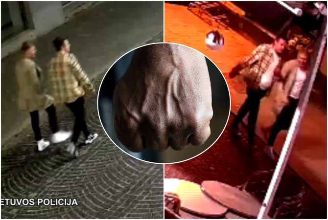 Jaunas vyras vis dar medikų rankose: prašo pagalbos surandant jį Vilniuje sumušusį asmenį
