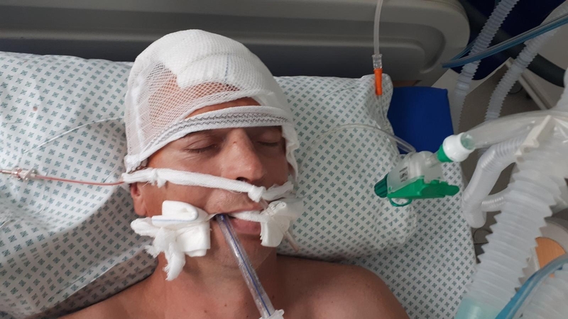 Šiauliuose rastas sužalotas vyras: policija prašo atpažinti