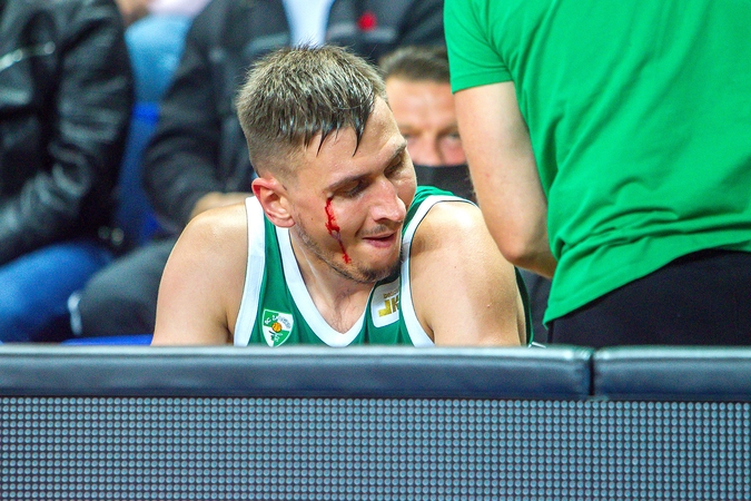 Rungtynių įkarštyje Edgarui Ulanovui buvo prakirstas antakis