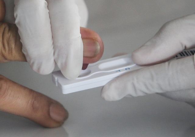 Mokslininkai sukūrė medžiagą, užtikrinsiančią patikimesnius koronaviruso testus