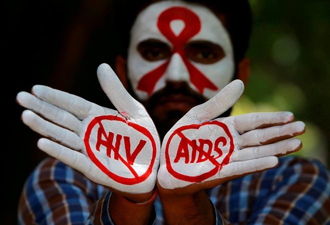 Galvos skausmą kelia ir AIDS plitimas, ir galimybės gydytis