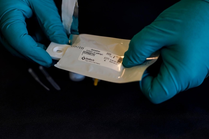 Belgijos biotechnologijų įmonė pradėjo gaminti antikūnių testus