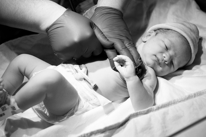 Vertinimas: slaugytojo, akušerio ar gydytojo veika, kai dėl jo kaltės paciento sveikatai buvo padaryta žala, sukėlusi paciento neįgalumą arba mirtį, laikoma šiurkščia medicinos praktikos arba slaugos ar akušerijos praktikos klaida.