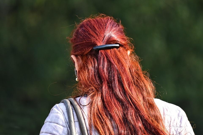 Vargina pleiskanos? Priežastis gali būti daug paprastesnė, nei manėte