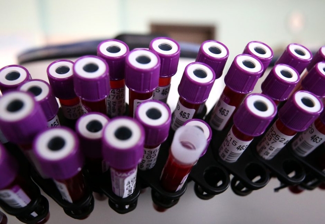Nuo gegužės pradžios dėl COVID-19 galima tirtis ir mokamai privačiose laboratorijose